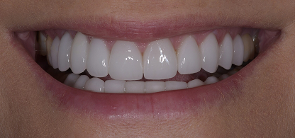 Case 2 Image