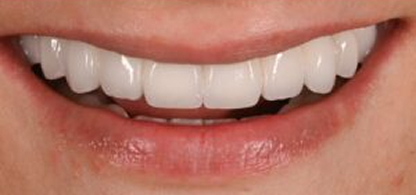 Case 3 Image