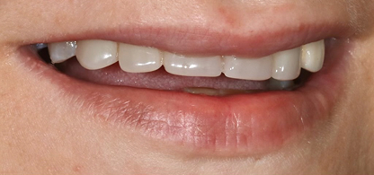 Case 3 Image
