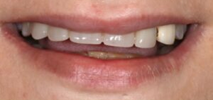 Case 3 Image