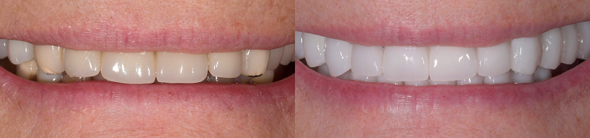 Case 4 Case Image