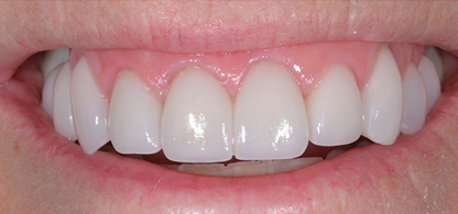 Case 10 Image